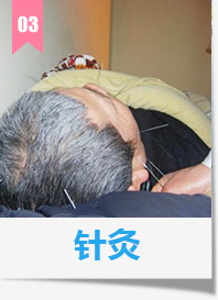针灸